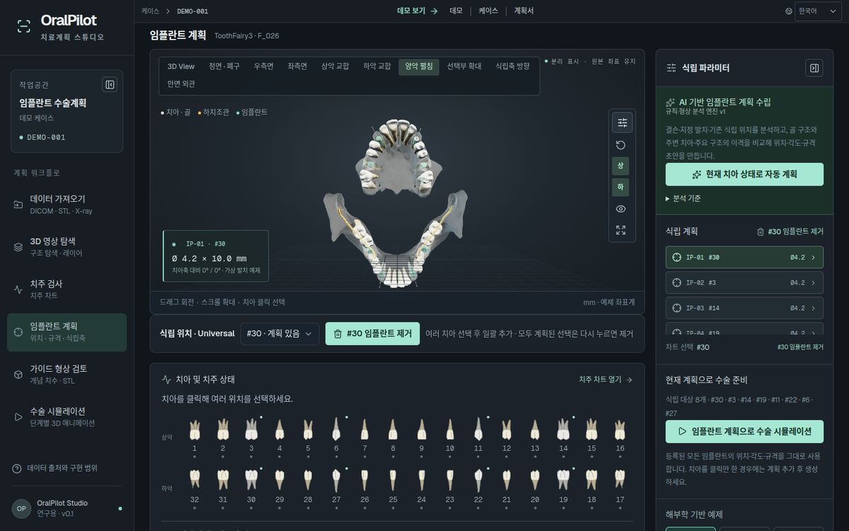 OralPilot 화면 — 양악 펼침 · 교합면