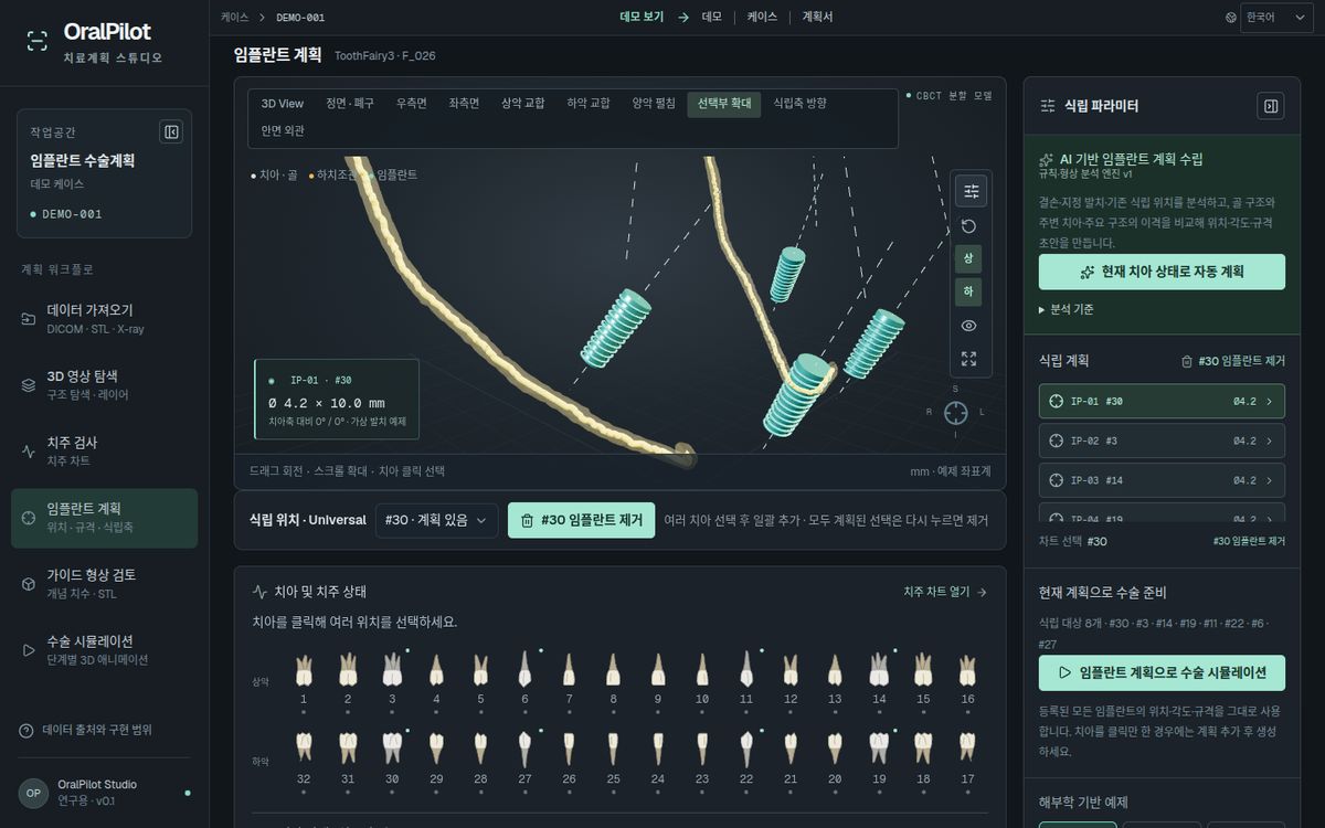 OralPilot 화면 — 임플란트·신경관만 보기