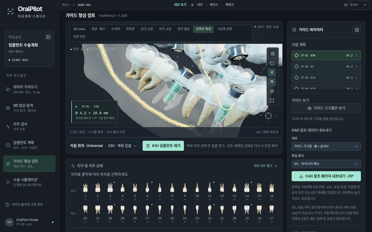 OralPilot 화면 — 가이드 형상 확대