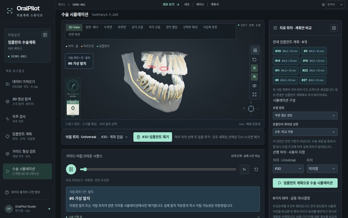 OralPilot 화면 — 수술 시뮬레이션